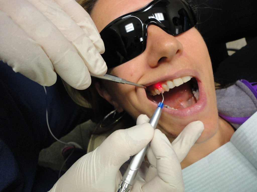  Laser Treatments Include